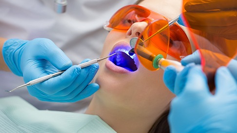 Dentists applying UV light to woman’s dental bonding