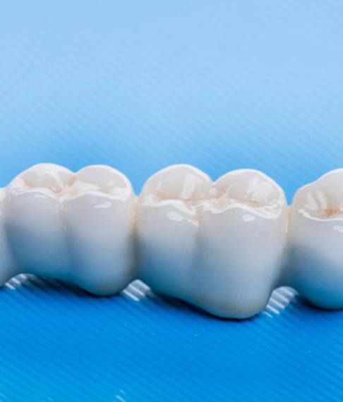 A dental bridge on a table 