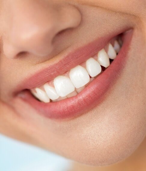 Closeup of flawless smile after gum recontouring