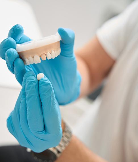 A dental crown being placed on a model of the jaw