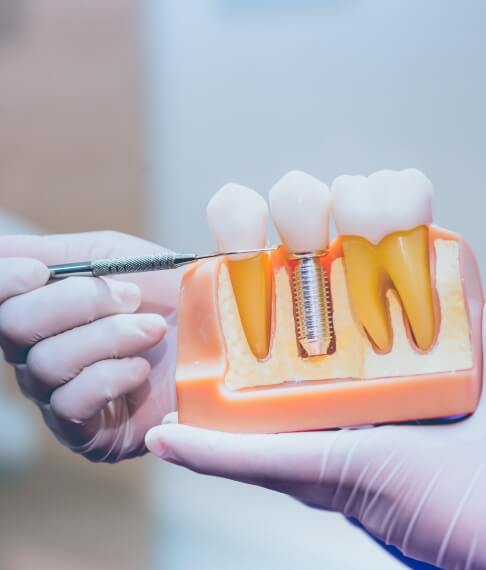 Dentist pointing to model showing natural teeth and dental implant supported replacement tooth