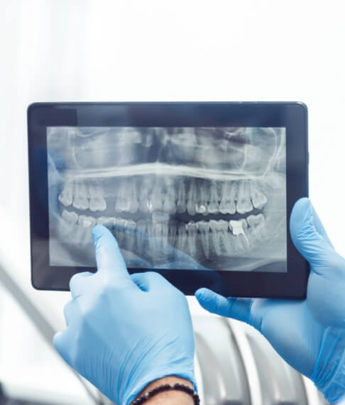 Dentist showing patient digital x-rays