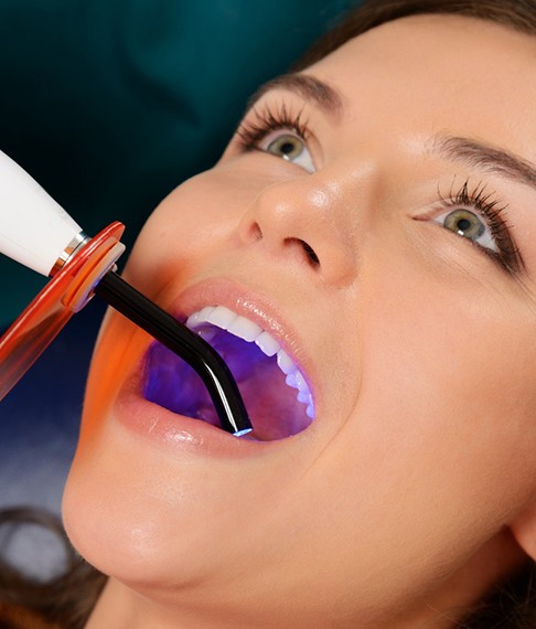 Woman having a tooth-colored filling put in place