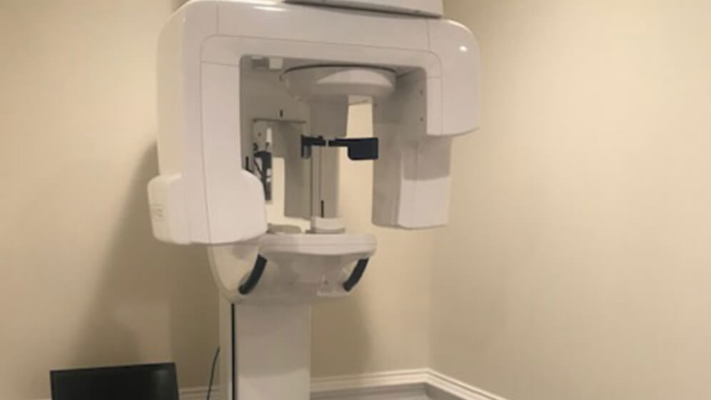 3 D C T cone beam digital x-ray scanner